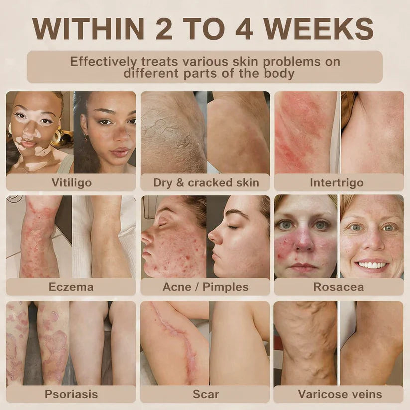 Zorexio® Biotin 10-in-1 Skin Restoration Cream