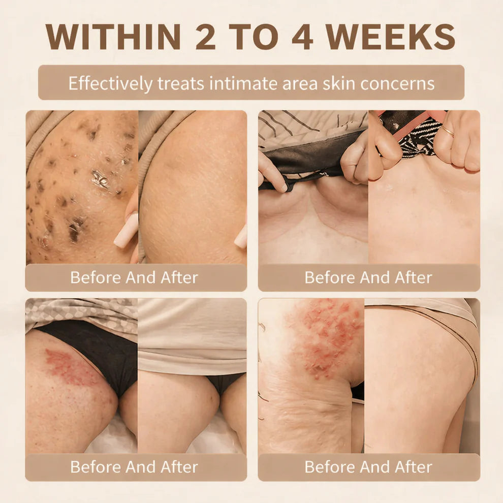 Zorexio® Biotin 10-in-1 Skin Restoration Cream