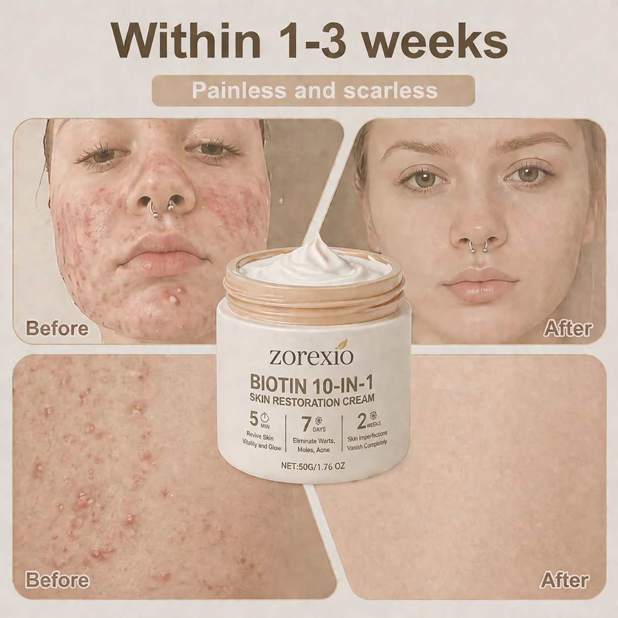 Zorexio® Biotin 10-in-1 Skin Restoration Cream